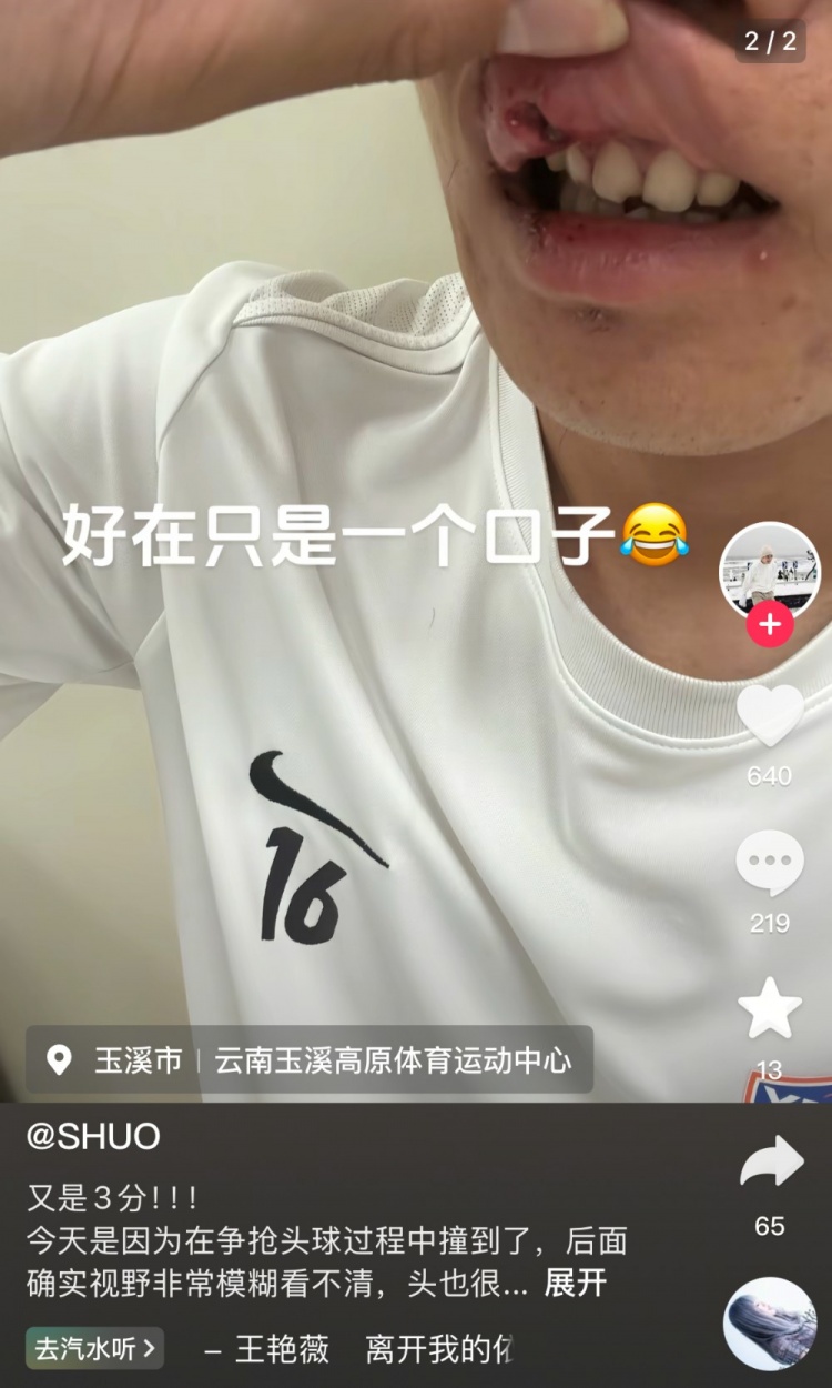 玉昆后卫晒受伤照：提前换下因争头球撞到了 视野模糊看不清&amp;头晕